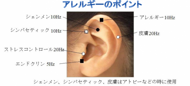 アレルギーポイント