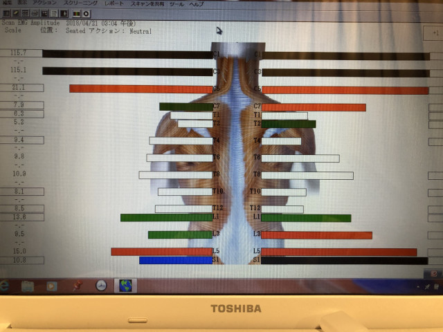 表面筋電計検査結果画像