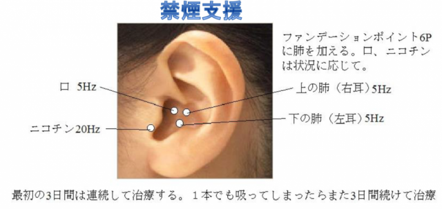 禁煙支援ポイント